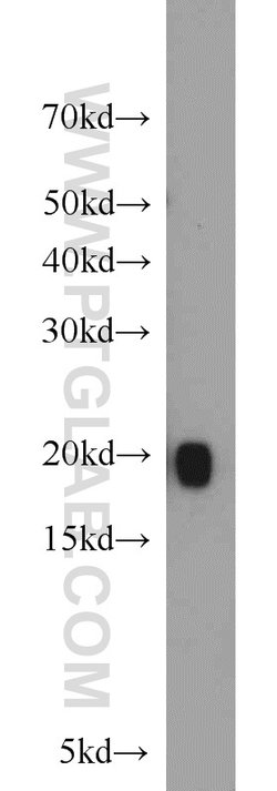 MYL12A Rabbit anti-Human, Mouse, Rat, Polyclonal, Proteintech 150 &mu;L;