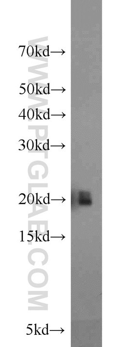 MYL12A Rabbit anti-Human, Mouse, Rat, Polyclonal, Proteintech 150 &mu;L;
