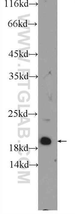 MYL12A Rabbit anti-Human, Mouse, Rat, Polyclonal, Proteintech 150 &mu;L;