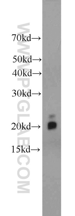MYL12A Rabbit anti-Human, Mouse, Rat, Polyclonal, Proteintech 150 &mu;L;