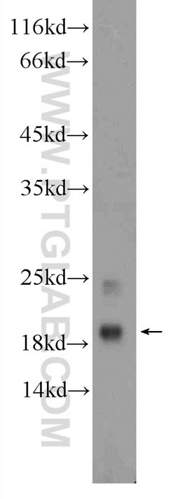 MYL12A Rabbit anti-Human, Mouse, Rat, Polyclonal, Proteintech 150 &mu;L;