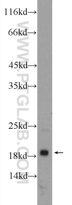 MYL12A Rabbit anti-Human, Mouse, Rat, Polyclonal, Proteintech 150 &mu;L;