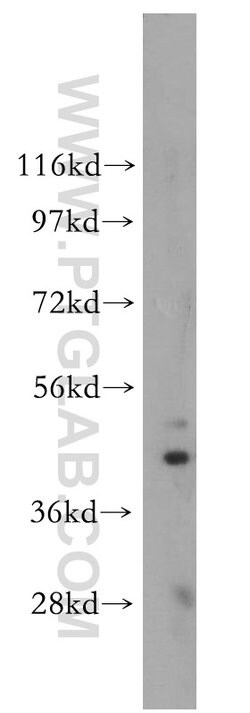 ARC/ARG3.1 Rabbit anti-Human, Mouse, Rat, Polyclonal, Proteintech:Anticuerpos:Anticuerpos