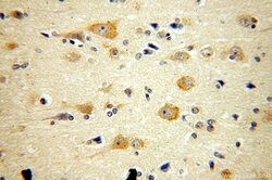 ARC/ARG3.1 Rabbit anti-Human, Mouse, Rat, Polyclonal, Proteintech:Anticuerpos:Anticuerpos