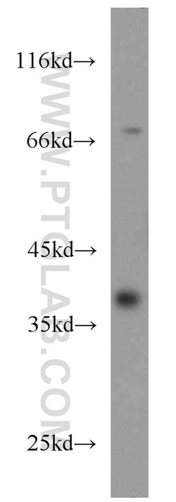 CDC37L1 Rabbit anti-Human, Polyclonal, Proteintech 20 &mu;L; Unconjugated:Anticuerpos