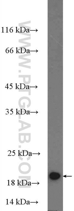 MRPL22 Rabbit anti-Human, Mouse, Rat, Polyclonal, Proteintech:Antibodies:Primary