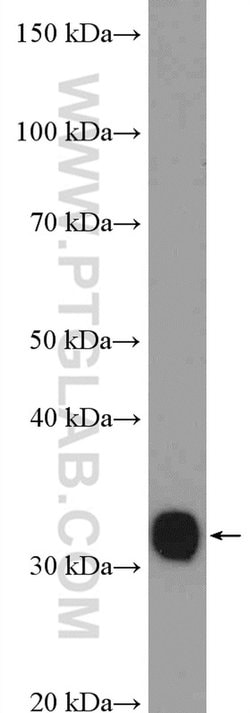 TST Rabbit anti-Human, Mouse, Rat, Polyclonal, Proteintech 150 &mu;L; Unconjugated:Antibodies,