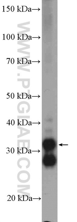 TST Rabbit anti-Human, Mouse, Rat, Polyclonal, Proteintech 150 &mu;L; Unconjugated:Antibodies,
