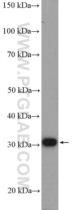 TST Rabbit anti-Human, Mouse, Rat, Polyclonal, Proteintech 150 &mu;L; Unconjugated:Antibodies,