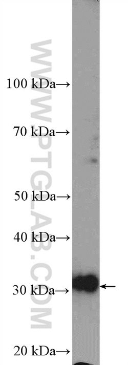 TST Rabbit anti-Human, Mouse, Rat, Polyclonal, Proteintech 150 &mu;L; Unconjugated:Antibodies,