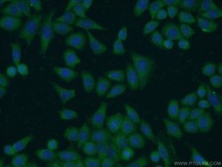 FN3KRP Rabbit anti-Human, Mouse, Rat, Polyclonal, Proteintech 150 &mu;L;