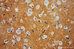 FN3KRP Rabbit anti-Human, Mouse, Rat, Polyclonal, Proteintech 150 &mu;L;