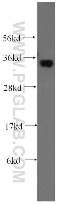 FN3KRP Rabbit anti-Human, Mouse, Rat, Polyclonal, Proteintech 150 &mu;L;