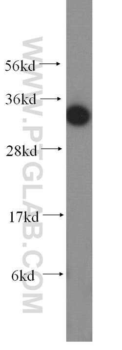 FN3KRP Rabbit anti-Human, Mouse, Rat, Polyclonal, Proteintech 150 &mu;L;