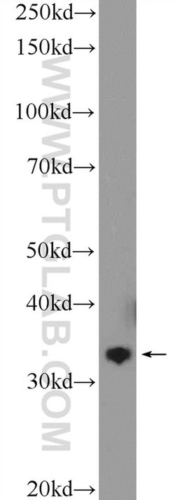 FN3KRP Rabbit anti-Human, Mouse, Rat, Polyclonal, Proteintech 150 &mu;L;