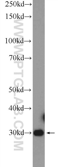FN3KRP Rabbit anti-Human, Mouse, Rat, Polyclonal, Proteintech 150 &mu;L;
