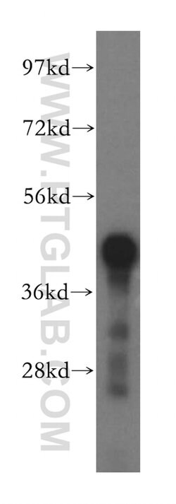 GCAT Rabbit anti-Human, Mouse, Rat, Polyclonal, Proteintech 150 &mu;L;