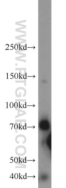 OCTN2 Rabbit anti-Human, Mouse, Rat, Polyclonal, Proteintech:Antibodies:Primary