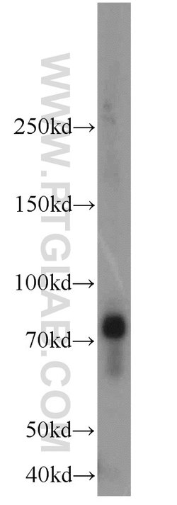 OCTN2 Rabbit anti-Human, Mouse, Rat, Polyclonal, Proteintech:Antibodies:Primary