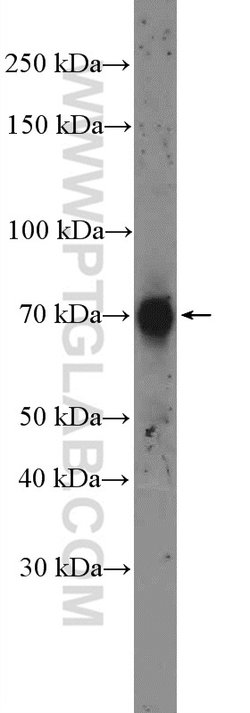 OCTN2 Rabbit anti-Human, Mouse, Rat, Polyclonal, Proteintech:Antibodies:Primary