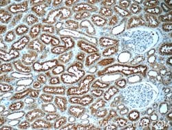 OCTN2 Rabbit anti-Human, Mouse, Rat, Polyclonal, Proteintech:Antibodies:Primary