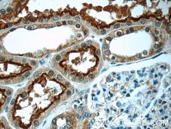 OCTN2 Rabbit anti-Human, Mouse, Rat, Polyclonal, Proteintech:Antibodies:Primary