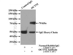 OCTN2 Rabbit anti-Human, Mouse, Rat, Polyclonal, Proteintech:Antibodies:Primary