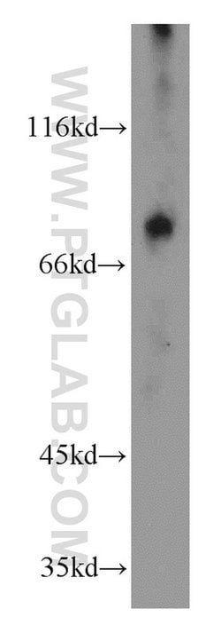 OCTN2 Rabbit anti-Human, Mouse, Rat, Polyclonal, Proteintech:Antibodies:Primary