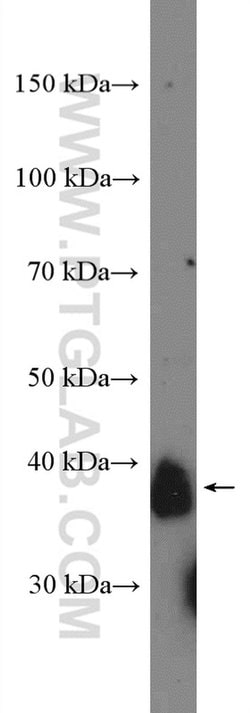 CD157 Rabbit anti-Human, Mouse, Rat, Polyclonal, Proteintech 20 &mu;L;