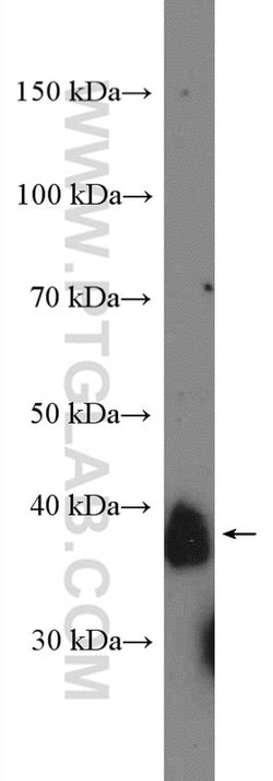 CD157 Rabbit anti-Human, Mouse, Rat, Polyclonal, Proteintech:  