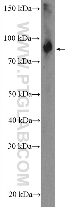 ABP1 Rabbit anti-Human, Mouse, Rat, Polyclonal, Proteintech 150 &mu;L | Buy Online | Proteintech Group Inc | Fisher Scientific