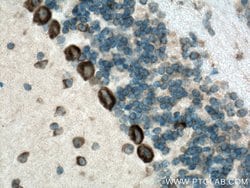 FARSB Rabbit anti-Human, Mouse, Rat, Polyclonal, Proteintech 150 &mu;L;