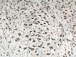 FARSB Rabbit anti-Human, Mouse, Rat, Polyclonal, Proteintech 150 &mu;L;