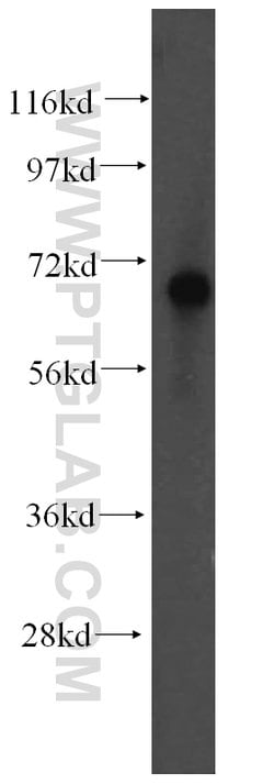 FARSB Rabbit anti-Human, Mouse, Rat, Polyclonal, Proteintech 150 &mu;L;