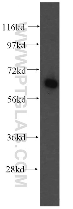 FARSB Rabbit anti-Human, Mouse, Rat, Polyclonal, Proteintech 150 &mu;L;