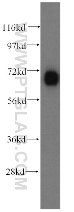 FARSB Rabbit anti-Human, Mouse, Rat, Polyclonal, Proteintech 150 &mu;L;