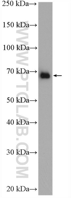 FARSB Rabbit anti-Human, Mouse, Rat, Polyclonal, Proteintech 150 &mu;L;