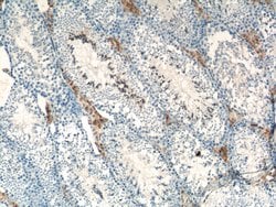 SLC35A1 Rabbit anti-Human, Mouse, Rat, Polyclonal, Proteintech 150 &mu;L;