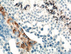 SLC35A1 Rabbit anti-Human, Mouse, Rat, Polyclonal, Proteintech 150 &mu;L;