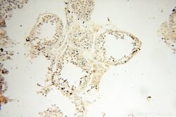 MRPS21 Rabbit anti-Human, Mouse, Rat, Polyclonal, Proteintech 150 &mu;L;