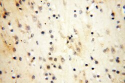 MRPS21 Rabbit anti-Human, Mouse, Rat, Polyclonal, Proteintech 150 &mu;L;