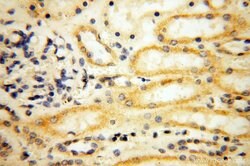 MRPS21 Rabbit anti-Human, Mouse, Rat, Polyclonal, Proteintech 150 &mu;L;