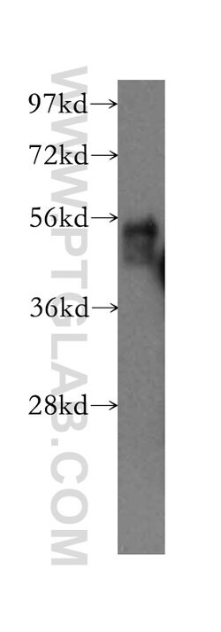 FZR1 Rabbit anti-Human, Mouse, Rat, Polyclonal, Proteintech 20 &mu;L; Unconjugated:Antikörper