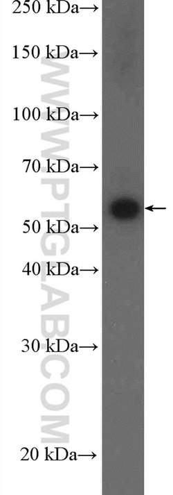 FZR1 Rabbit anti-Human, Mouse, Rat, Polyclonal, Proteintech 20 &mu;L; Unconjugated:Antikörper