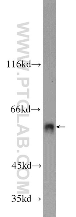 FZR1 Rabbit anti-Human, Mouse, Rat, Polyclonal, Proteintech 20 &mu;L; Unconjugated:Antikörper