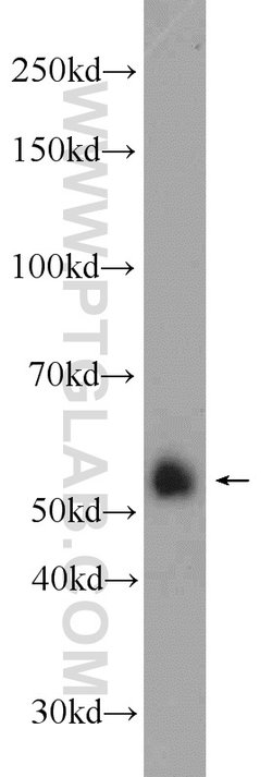 FZR1 Rabbit anti-Human, Mouse, Rat, Polyclonal, Proteintech 20 &mu;L; Unconjugated:Antikörper