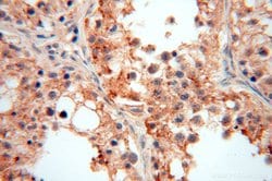 PIGO Rabbit anti-Human, Mouse, Rat, Polyclonal, Proteintech 150 &mu;L;