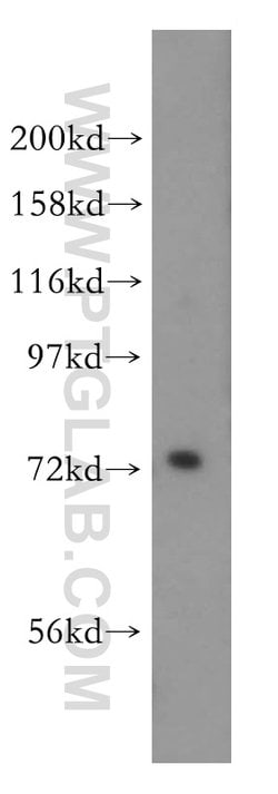 PIGO Rabbit anti-Human, Mouse, Rat, Polyclonal, Proteintech 150 &mu;L;
