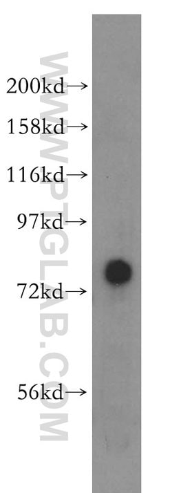 PIGO Rabbit anti-Human, Mouse, Rat, Polyclonal, Proteintech 150 &mu;L;