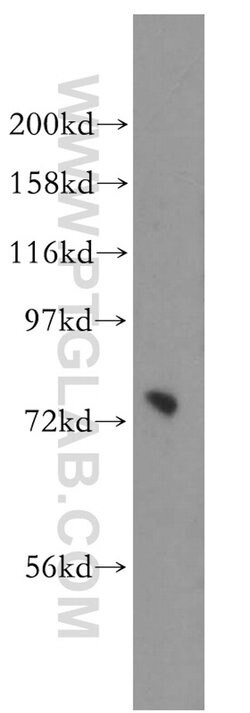 PIGO Rabbit anti-Human, Mouse, Rat, Polyclonal, Proteintech 150 &mu;L;
